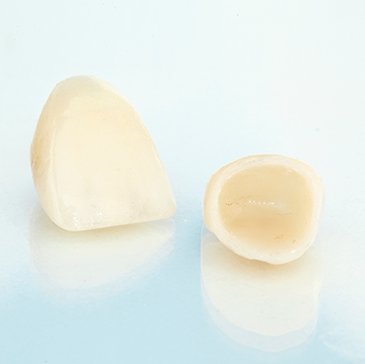 A closeup of ceramic dental crowns